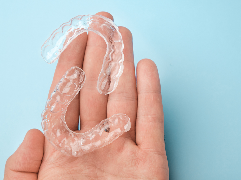 clear aligners